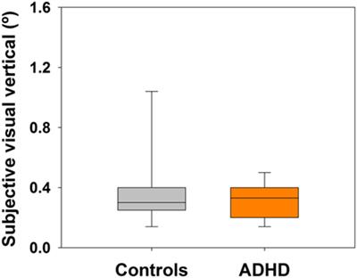 Altered Cervical Vestibular-Evoked Myogenic Potential in Children with Attention Deficit and Hyperactivity Disorder